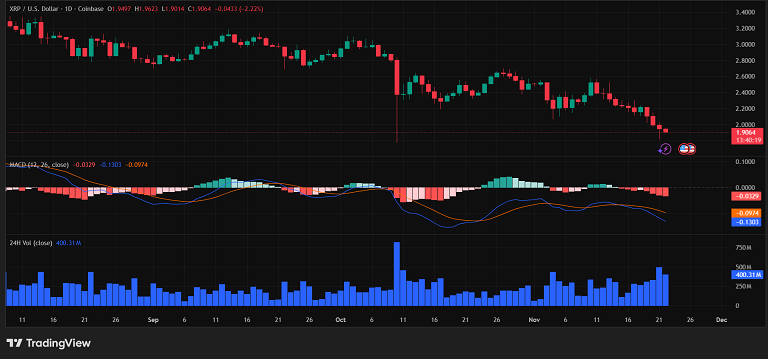 ریپل هنوز زیر فشار MACD منفی